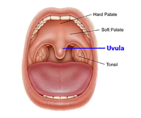 Uvulitis in adults
